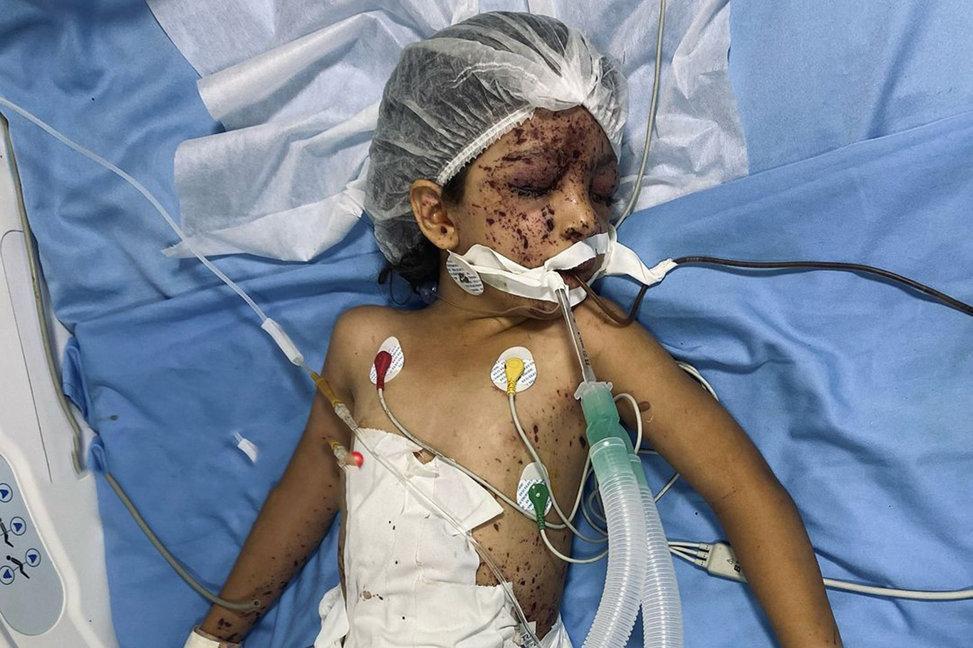 Dünya Sağlık Günü'nde Gazze'deki sağlık durumu hakkında çarpıcı rakamlar