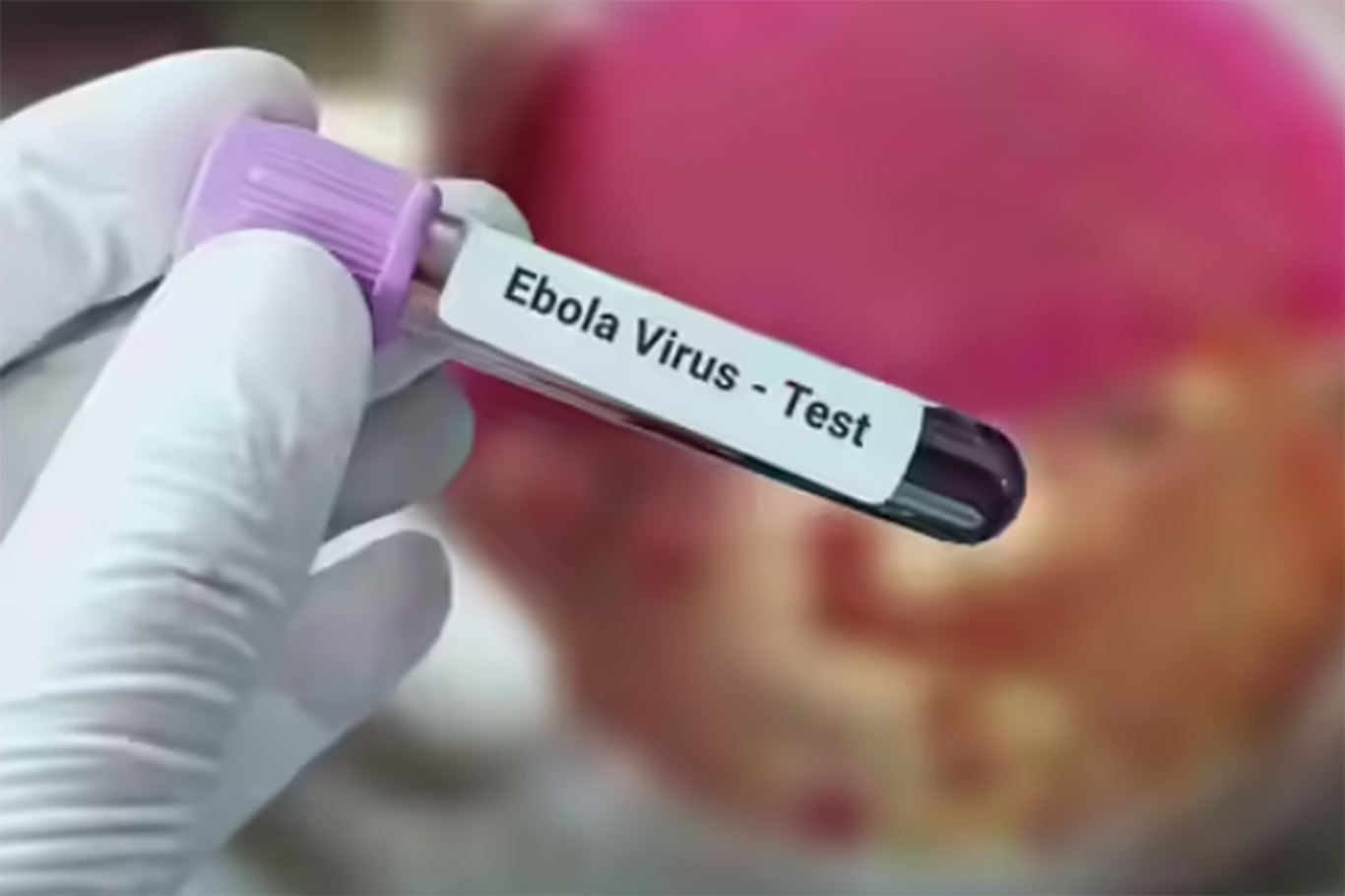 Avrupa'da Ebola salgını alarmı: Önce İtalya şimdi de Avusturya'da karantina kararı