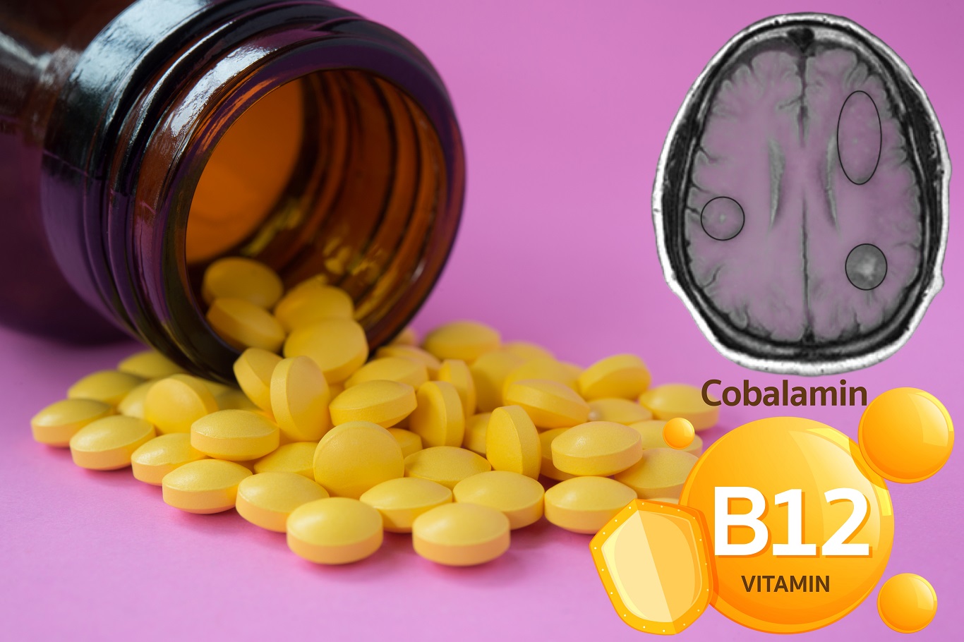 B12 vitamini herkes için gerekli mi? Bilinçsiz kullanımın perde arkası