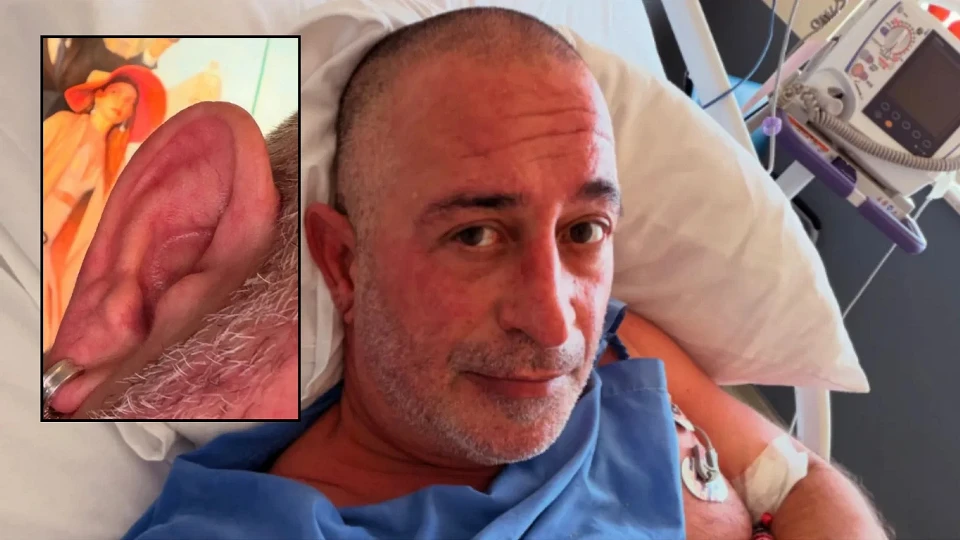 Kulağındaki çizgi ‘kalp krizi işareti’ diye gündem olmuştu: Cem Yılmaz yakınlaştırıp paylaştı